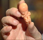 муляж 10-недельного плода