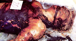 Тело убитого боснийцами-мусульманами серба Милана Вуйчича было обезображено и подожжено