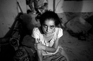 Эта 24-летняя девушка – героиновая наркоманка. Фото: Cristian Movila for TIME