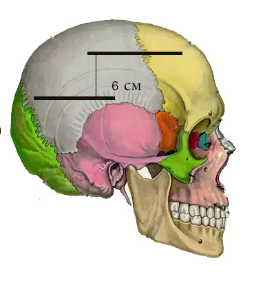 Рис.3. Фото черепа с отмеченным расположением ран на голове Цесаревича по их описанию в протоколе. Значительное расстояние между повреждениями.