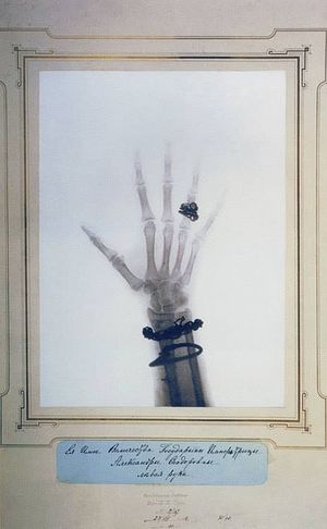 Рентгеновский снимок левой руки Императрицы Александры Феодоровны